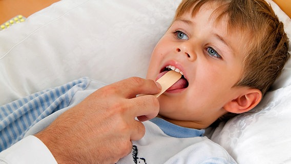 Ein Arzt untersucht ein Kind, das den Mund geöffnet hat. © dpa picture alliance 