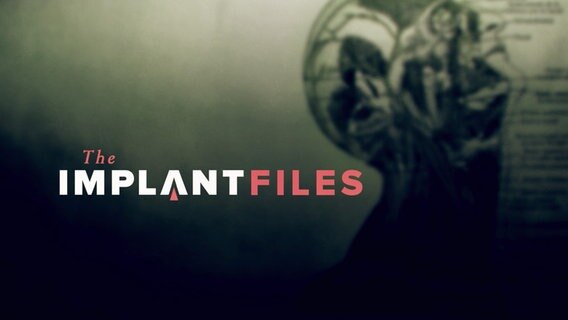 Titelgrafik "The Implant Files" © NDR/ARD 