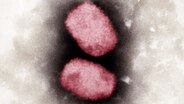 Elektronenmikroskopische Aufnahme von Affenpocken-Viren. © RKI/dpa Foto: Andrea Männel/Andrea Schnartendorff