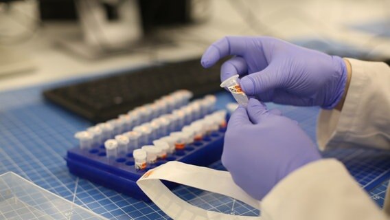 Ein PCR-Test wird bei der Firma Centogene in Rostock ausgeführt.  