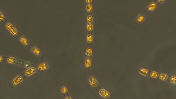 Die Kieselalge Skeletonema marinoi ist unter einem Mikroskop in starkter Vergrößerung zu sehen. Die Kieselalge Skeletonema marinoi ist unter einem Mikroskop in starkter Vergrößerung zu sehen. © Institut für Ostseeforschung Warnemünde Foto: S. Bolius