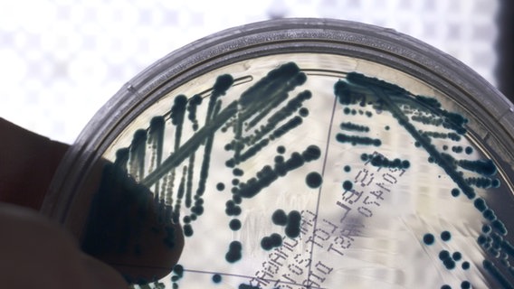 Eine Agarplatte mit Bakterien. © NDR 