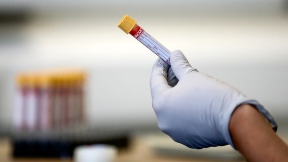 Eine Person hält eine Blutprobe in der Hand © picture alliance / empics 