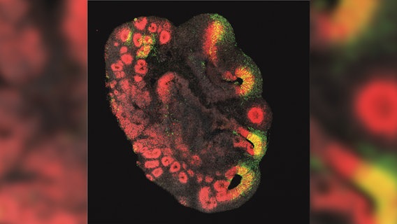 Ein etwa 3 Millimeter großes Hirnorganoid, das aus Stammzellen eines Schimpansen hergestellt wurde. © Deutsches Primatenzentrum 