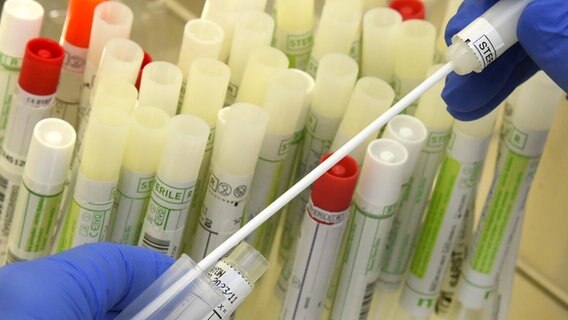 In einem PCR-Labor bereitet eine Mitarbeiterin Abstrichtupfer von Patienten für die SARS-CoV-2-Diagnostik an einem Analysegerät vor. © picture alliance/dpa/dpa-Zentralbild Foto: Waltraud Grubitzsch