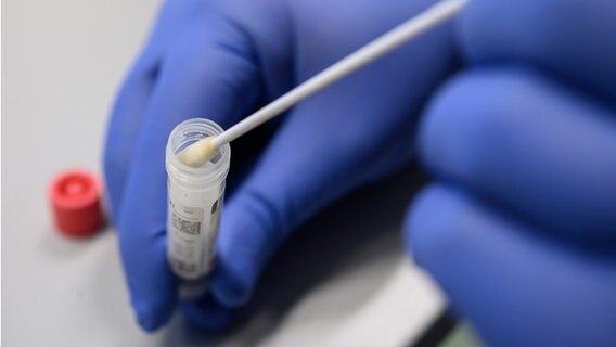 Ein Arzt zeigt einen Abstrich für das Testverfahren auf das Virus SARS-CoV-2. © dpa-Bildfunk Foto: Sebastian Gollnow