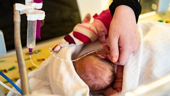 Ein frühgeborenes Baby wird von seiner Mutter gestreichelt. © picture alliance/dpa/Andreas Arnold Foto: Andreas Arnold