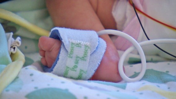 Der Fuß eines Frühgeborenen. © NDR 