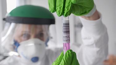 Eine wissenschaftliche Mitarbeiterin des Landesamts für Verbraucherschutz und Lebensmittelsicherheit hält eine Coronavirus-Testprobe in den Händen. © dpa - Bildfunk Foto: Peter Steffen