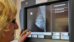Eine medizinisch-technische Radiologieassistentin betrachtet in Hannover in dem Mammografie Screening Zentrum eine Aufnahme einer Brust. © dpa Foto: Angelika Warmuth