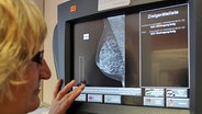 Eine medizinisch-technische Radiologieassistentin betrachtet in Hannover in dem Mammografie Screening Zentrum eine Aufnahme einer Brust. © dpa Foto: Angelika Warmuth