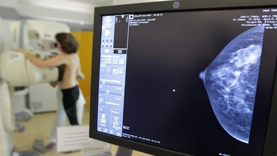 Eine Frau bei einer Mammographie © picture alliance / maxppp Foto: François Destoc
