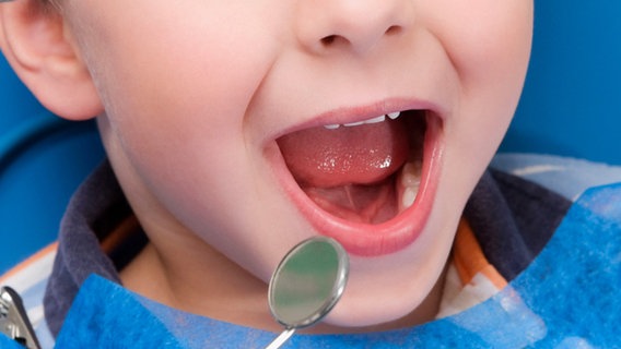 Ein Kind sitzt mit geöffnetem Mund beim Zahnarzt. © picture alliance/VisualEyze 