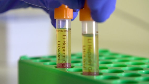 Eine Medizinerin steckt ein Reagenzglas in eine spezielle Halterung in einem Labor an der UKSH. © NDR 
