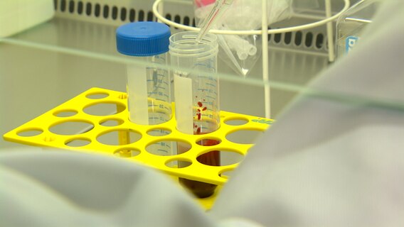 Blut wird mit einer Pipette in einen Messbecher gefüllt. © NDR 