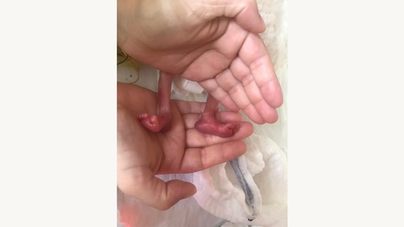Die kleinen Beine der frühgeborenen Lotta in den Händen eines Elternteils. © NDR 