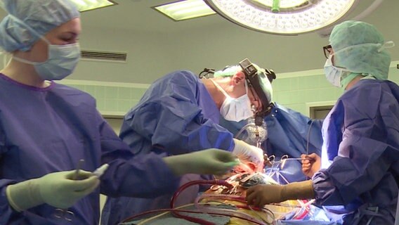 Mehrere Ärzte während der Transplantation einer Herzklappe. © NDR 