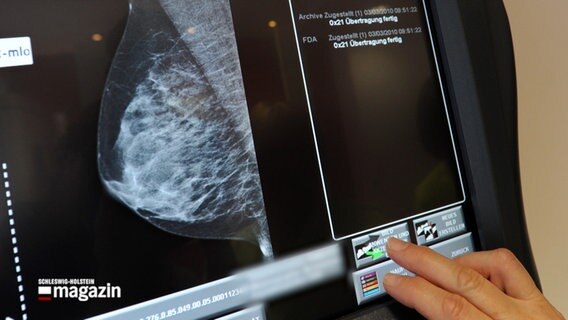 Eine Röntgenaufnahme einer weiblichen Brust auf einem Bildschirm. © NDR 