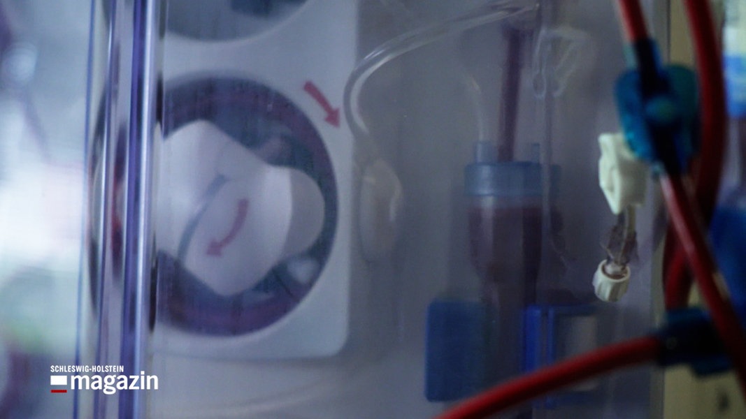 Ein Blick auf eine Dialyse-Maschine