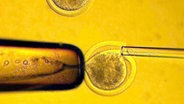 Übertragung einer Körperzelle in eine entkernte Eizelle, Praxis zur Herstellung von Stammzellen zum therapeutischen Klonen von Gewebe © picture-alliance/dpa Foto: epa