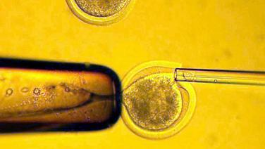 Übertragung einer Körperzelle in eine entkernte Eizelle, Praxis zur Herstellung von Stammzellen zum therapeutischen Klonen von Gewebe © picture-alliance/dpa Foto: epa