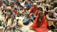 Hungersnot in Afrika: Somalia 1992 © picture alliance Foto: Jul