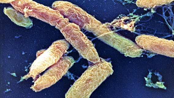Mikroskopische Aufnahme des Pesterregers, des Bakteriums Yersinia pestis © picture-alliance / OKAPIA KG, Germany Foto: Dr. Gary Gaugler