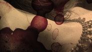 Diamantencollier am Hals einer Frau, darüber Blutflecken in einer Collage. © photocase / hulibu / Grammbo (m) Foto: hulibu / Grammbo