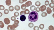 Eine Mikroskopaufnahme eines Blutausstrichs im Labor zeigt lila eingefärbte neutrophile Granulozyten, eine Untergruppe der weißen Blutkörperchen, fotografiert in 400facher Vergrößerung. © Picture Alliance Foto: Gladden W. Willis