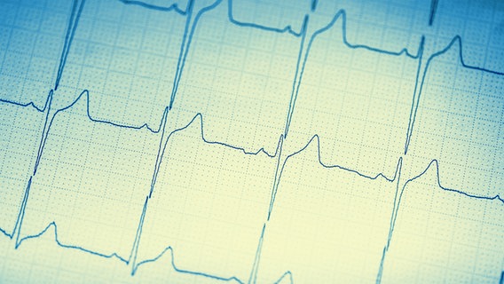 Die Kurve eines EKG © Colourbox Foto: Marian Vejcik