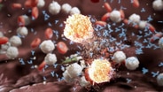 Das Immunsystem greift Zellen des eigenen Körpers an. © NDR Foto: NDR Screenshot