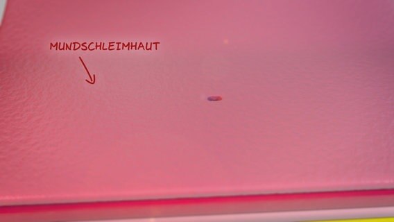 Schematische Darstellung: Mundschleimhaut mit kleinem Loch. © NDR Foto: tonic trix