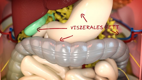 Schematische Darstellung: viszerales Fett im Bauchraum. © NDR 