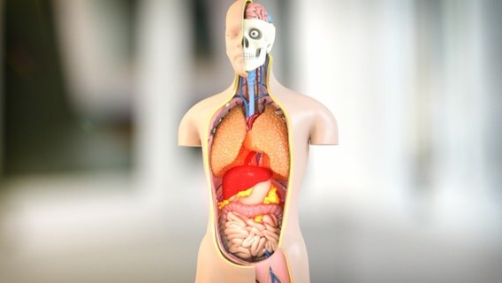 Schematische Darstellung: Torso mit Entzündung im Bauchraum. © NDR 