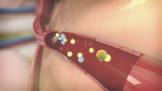 Schematisch Darstellung: Blutgefäß mit fließenden Teilchen. © NDR 