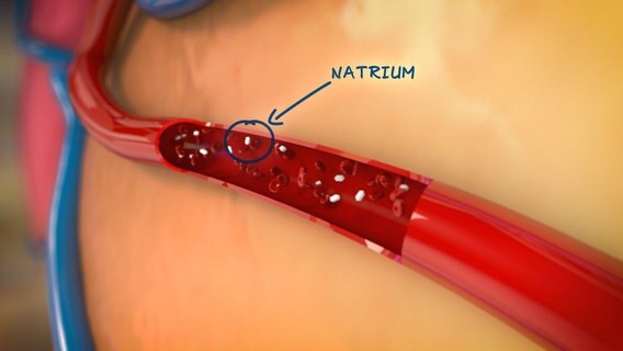 Schematische Darstellung: Natrium im Blut © NDR Foto: tonic trix