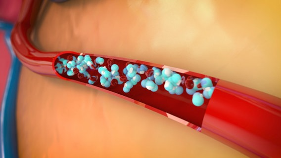 Schematische Darstellung: Natrium bindet Wasser im Blut © NDR Foto: tonic trix