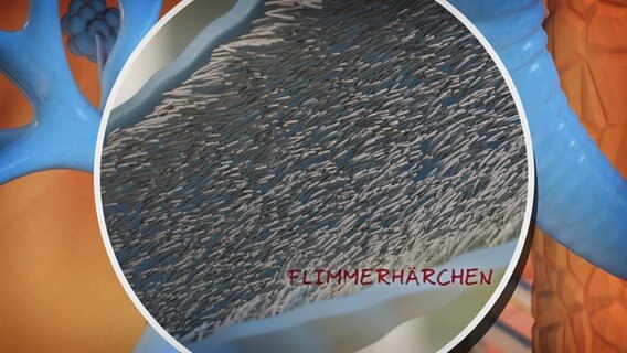 Schematische Darstellung: Flimmerhärchen in einem Bronchialast. © NDR 