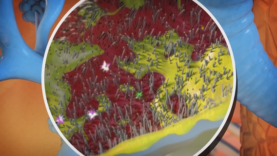 Schematische Darstellung: Bronchialschleimhaut wird rot und langsam von einem gelben Schleim überzogen. © NDR 