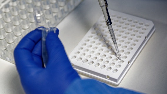 PCR-Tests were carried out in einem Labor.  © picture alliance/dpa |  Henning Kaiser Photo: Henning Kaiser