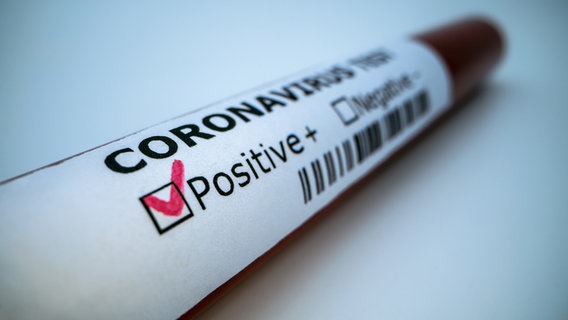 Ein Laborröhrchen aus Glas auf dem Coronavirus positiv angekreuzt ist. © PantherMedia Foto: RECSTOCKFOOTAGE