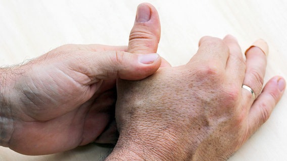 A man grasps his thumb joint © Fotolia.com Photo: Astrid Gast