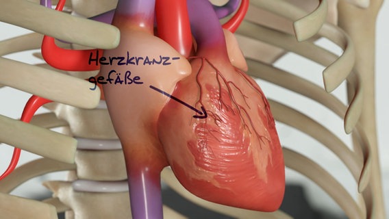 Grafische Darstellung: Herz mit umliegenden Gefäßen. © NDR 