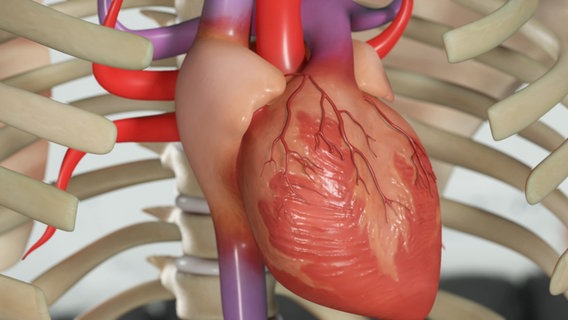 Grafische Darstellung: Herz mit Herzkranzgefäßen. © NDR 