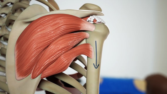 Schematische Darstellung: Oberarm wird nach unten gezogen von den drei hinteren Schultermuskeln. © NDR 