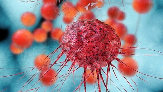 Krebszellen in einer 3D-Grafik. © fotolia.com Foto: fotoliaxrender