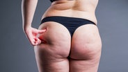 Eine Frau im String-Tanga drückt die Haut an ihrem Po mit zwei Fingern zusammen. © Panthermedia Foto: Panthermedia | starast