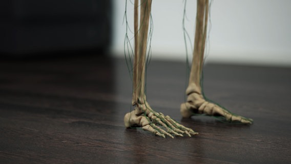 Schematische Darstellung: Lymphbahnen in den Beinen und Füßen. © NDR 
