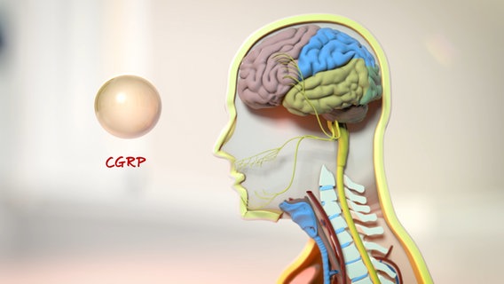 Schematische Darstellung: Schädel mit Gehirn im Anschnitt, davor Kugel mit Beschriftung: CGRP © NDR Foto: tonic trix