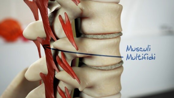 Bewegungstherapie Bei Spinalkanalstenose Ndr De Ratgeber Gesundheit